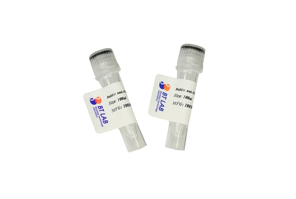 Product image Hepatitis B Surface Antigen adr subtype, CHO Protein