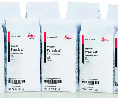 Product image Paraffin Tissue Section - NASH: Liver