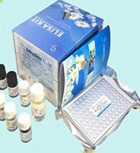 Product image Rat Platelet antibodies IgG ELISA kit